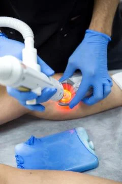 Doctors doing vein surgery procedure Stock Photos