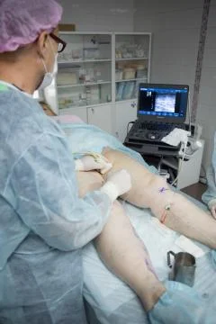 Doctors doing vein surgery procedure Foto stock