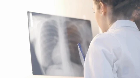 Doctors examining a patient's x-ray and discussing Stock Footage 86682419