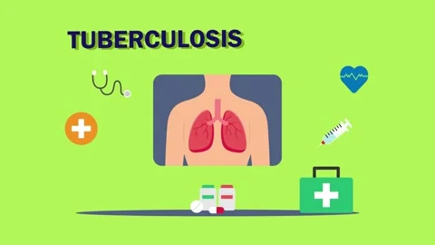Doctors examining tuberculosis disease on lungs Stock Footage 169981142