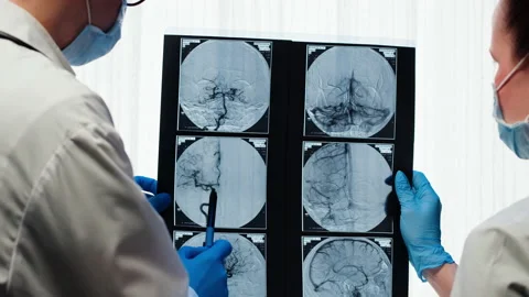 Doctors examining X-ray,brain MRI. Magnetic resonance image of head. Therapist Stock Footage 194515938
