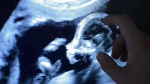 Doctor's hand analyzing mri scan of a fetus. fetus scan. 스톡 동영상 205884530