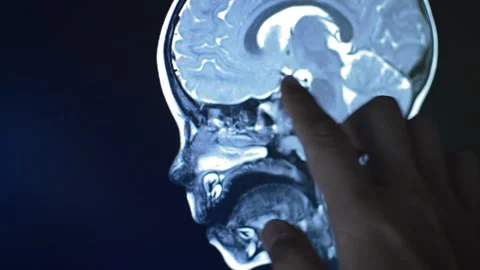 Doctor's hand analyzing patient anatomy's x-ray Stock Footage 200817044