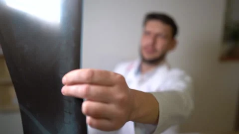 Doctors hand holds an x-ray picture of the patient. Close portrait. Doctor Stock Footage 145948151