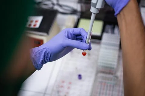 Doctor's hand using an eyedropper puts a blood sample Stock Photos
