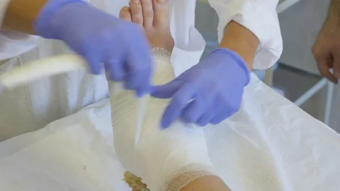 The doctor's hands are close-up, which makes a bandage on the foot of a sick Video stock 95442725