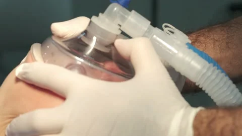 Doctor's hands are holding anesthesia mask on the patient's face Stock Footage 166945312