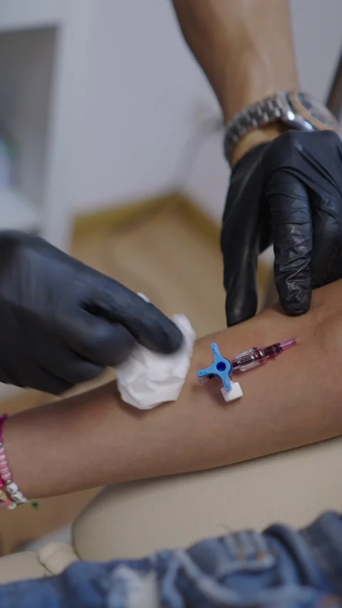 A doctors hands cleaning the area where the IV is in the arm Stock Footage 264580070