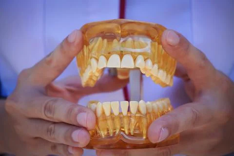 The doctors hands hold an artificial model of the jaw with breaks. The dent.. Stock Photos