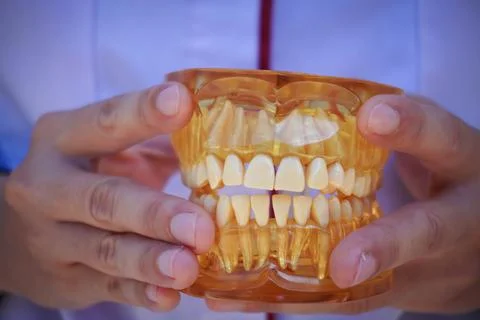 The doctors hands hold an artificial model of the jaw with breaks. The dent.. Stock Photos