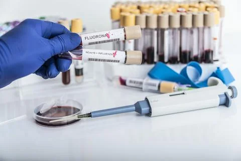 Doctor's hands hold blood samples of the new variant omicron plus flu FLUORONE Stock Photos