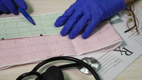 Doctor's hands hold result of the cardiogram next to patient sitting Stock Footage 263672657