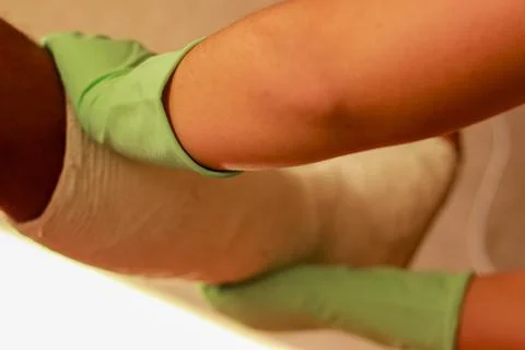 The doctor's hands put a plaster cast on the leg Stock-Fotos