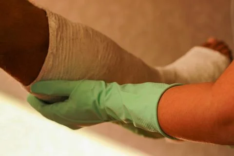 The doctor's hands put a plaster cast on the leg Stock Photos