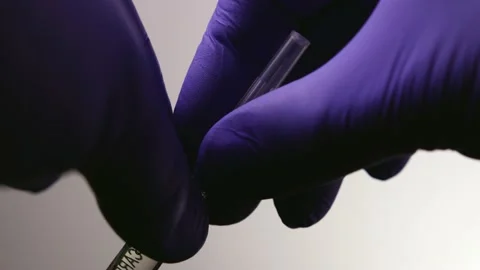 Doctor's hands remove the protective cap from the needle on the syringe Stock Footage 146940704