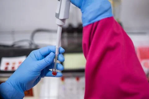 Doctor's hands with rubber gloves using a dropper when putting blood Stock Photos