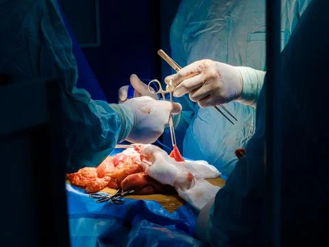 Doctors hands use surgical instruments during surgery. Stock Photos