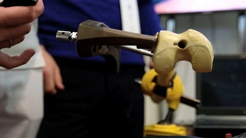 Doctors installing titanium rods in the bones Stock Footage 89567425