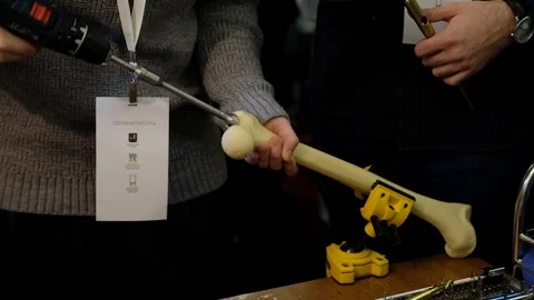 Doctors installing titanium rods in the bones Stock Footage 89567432