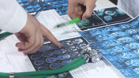 Doctors look at the chart and establish a diagnosis Stock Footage 86690386