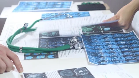 Doctors look at the chart and establish a diagnosis in the office Stock Footage 86690394