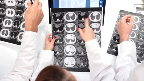  Doctors Looking Mri Close up Stock Footage 210669669