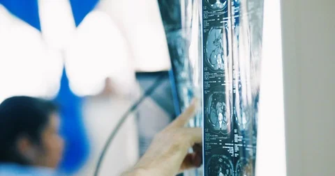 Doctors looking at X Ray on lightbox in hospital Stock Footage 126800893