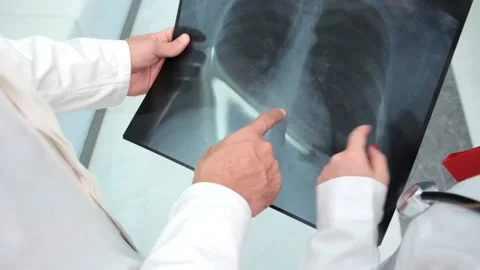  Doctors  looking an xray  Video stock 210670450