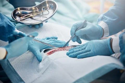 Doctors, nurses or surgery hands on cut patient in hospital emergency room for Stock Photos