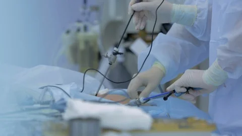Doctors in operating room carry out real endoscopic operation, tumor is cut out Stock Footage 128642822