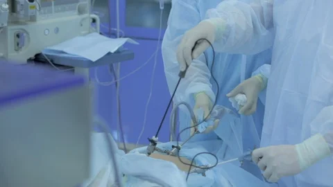 Doctors in operating room carry out real endoscopic operation, manipulators Video stock 128642890