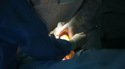 Doctors in the operating room, close-up Stock-Footage 41749304
