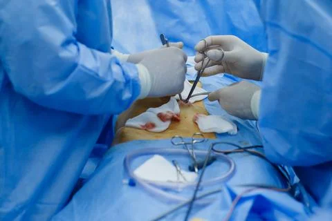 Doctors perform laparoscopy operations in the intensive care unit Stock Photos