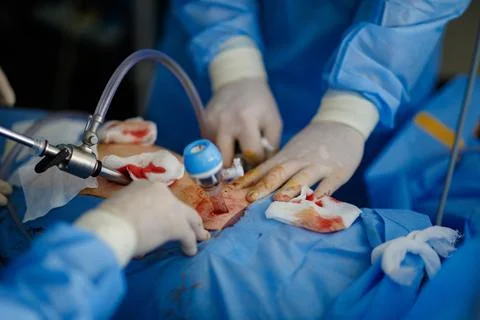 Doctors perform laparoscopy operations in the intensive care unit Stock Photos