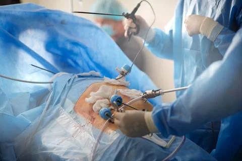 Doctors perform laparoscopy operations in the intensive care unit Stock Photos