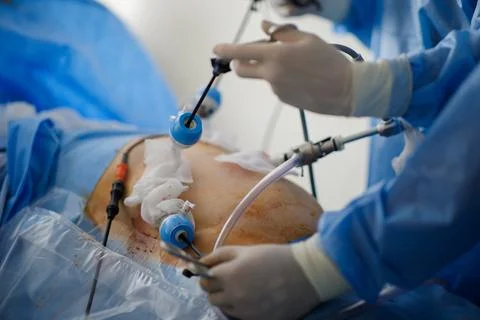 Doctors perform laparoscopy operations in the intensive care unit Stock Photos