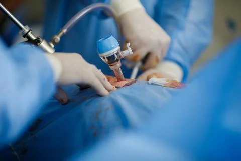 Doctors perform laparoscopy operations in the intensive care unit Stock Photos