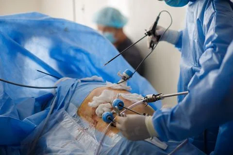 Doctors perform laparoscopy operations in the intensive care unit Stock Photos