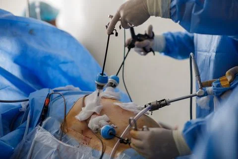 Doctors perform laparoscopy operations in the intensive care unit Stock Photos