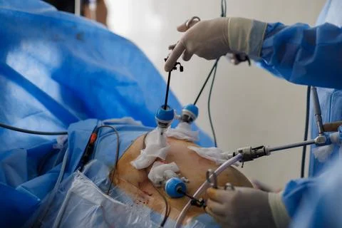 Doctors perform laparoscopy operations in the intensive care unit Stock Photos