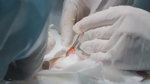 Doctors perform operation to remove appendix. Action. Surgeons operate on person Stock Footage 153286490