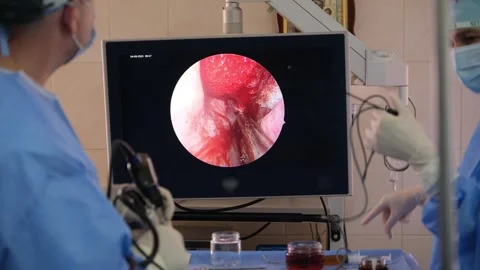 Doctors performing endoscopic surgery with real-time visualization Stock Footage 316398350