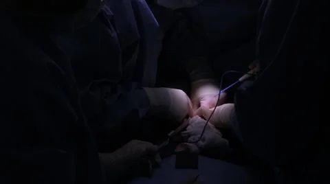 Doctors performing operation in operation theatre Stock Footage 62389073