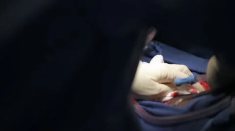 Doctors performing operation in operation theatre Stock Footage 62389086