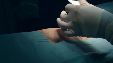 Doctors Performing Surgery in Operating Room. Stock Footage 91971457