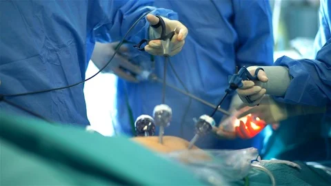 Doctors Performing Surgery in Operating Room. Stock Footage 92158262