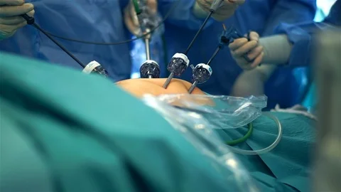 Doctors Performing Surgery in Operating Room. Stock Footage 92158302