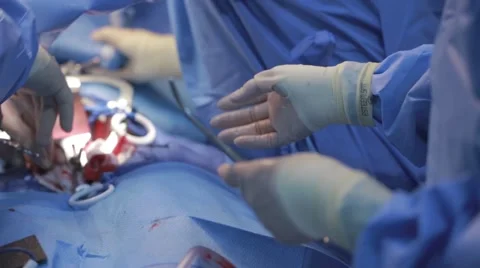 Doctors performing surgery on a patient Stock Footage 62389020