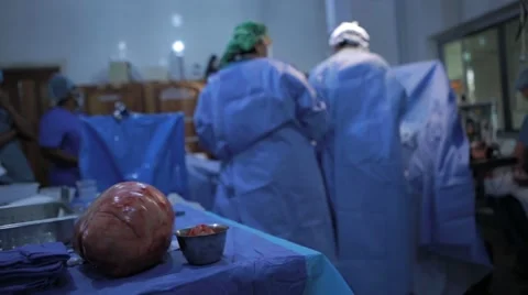 Doctors performing surgery on a patient Stock Footage 62389023
