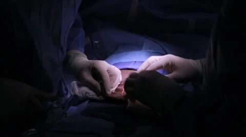 Doctors performing surgery on a patient Stock Footage 62389039